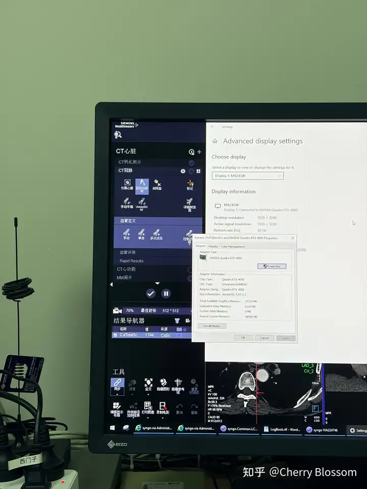 为什么还有人能忍受60hz的电脑屏幕？
