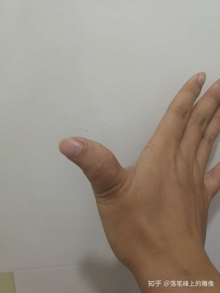 右手大拇指发麻 知乎