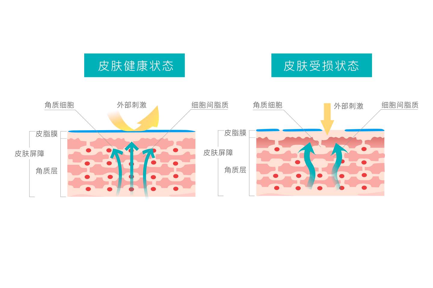 换季护肤 敏感肌如何应对 知乎