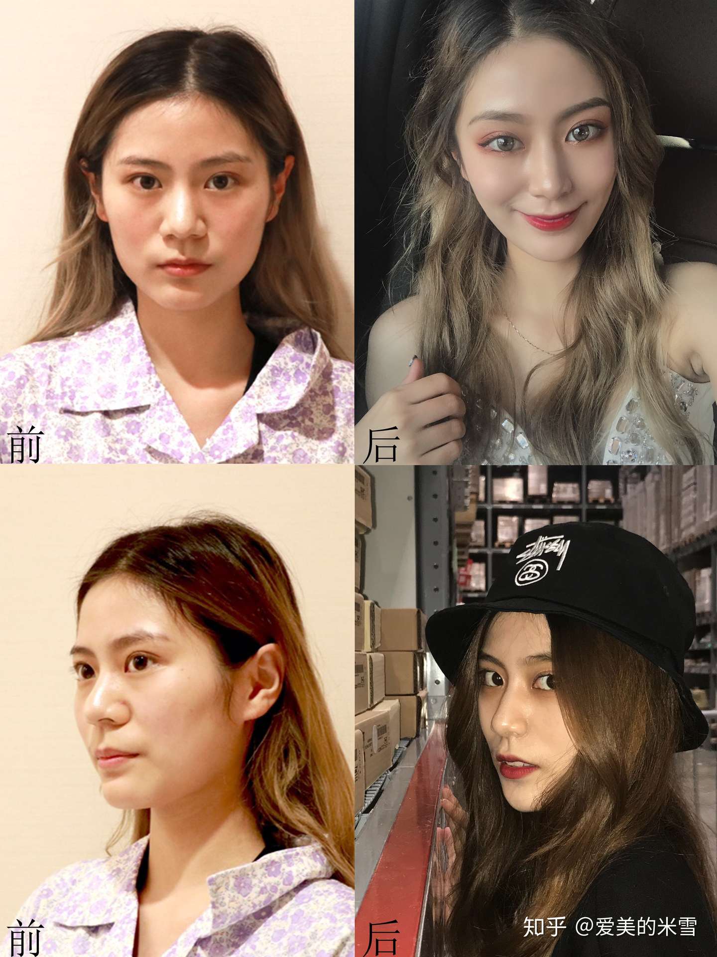 隆鼻哪里好 有推荐的吗 知乎