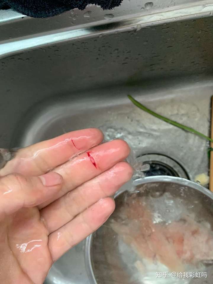 切菜时切到手是一种什么样的体验?