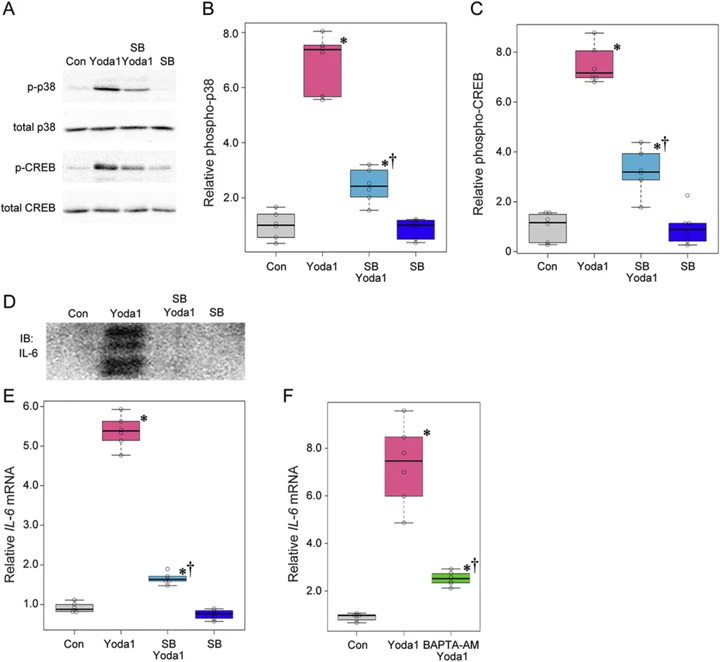 膜上皮細胞中機械感受器 Piezo1 通道介導的白細胞介素表達:將機械應力與眼部炎癥聯系起來 膜上皮細胞中機械感受器 Piezo1 通道介導的白細胞介素表達:將機械應力與眼部炎癥聯系起來
