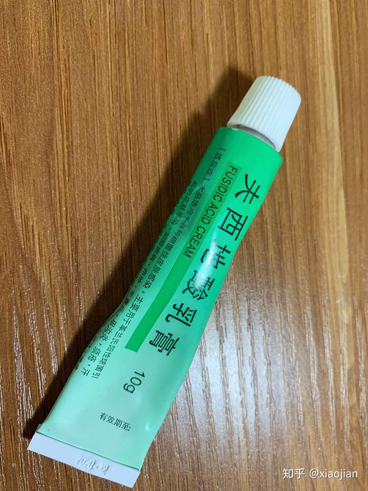 腋毛癣是怎么一回事该如何治