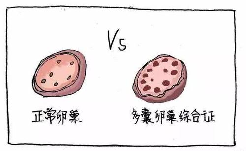 明明卵泡很多,偏偏不怀孕是怎么回事呢?插图(3) v2-646d99db48c2b01d13d1ed8d962a2581_720w.png插图(3)