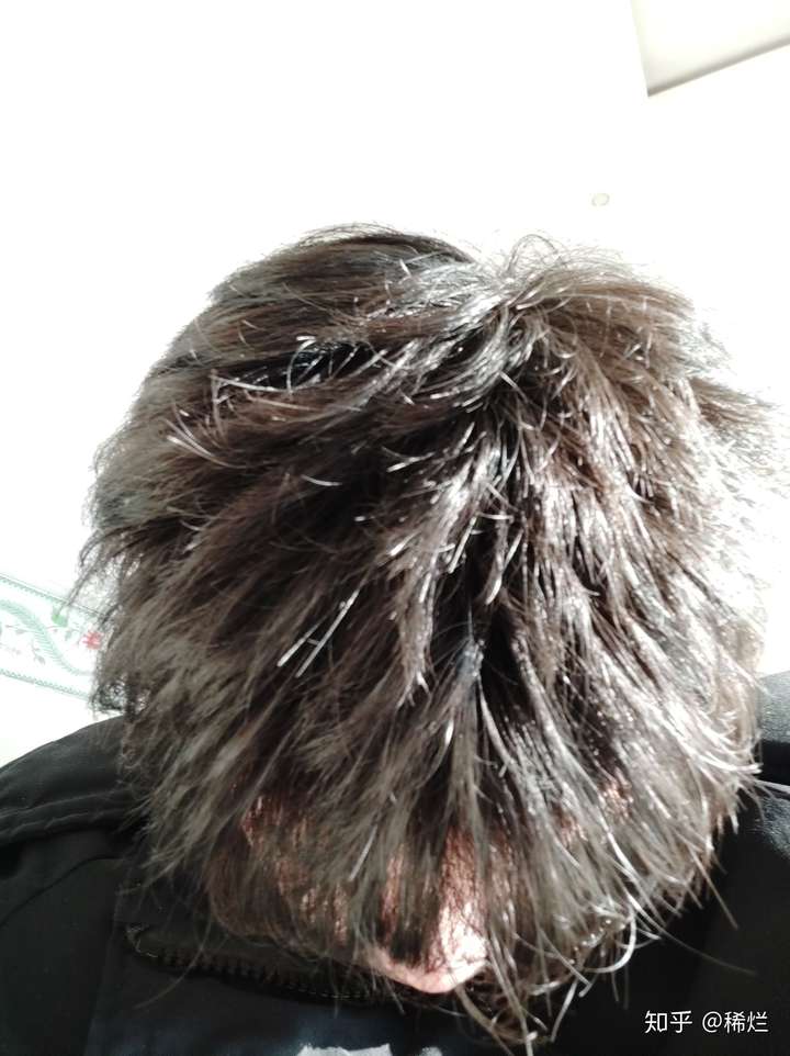 我的头发自然卷干燥分叉且不蓬松喜欢贴着头该怎么改善护理求推荐