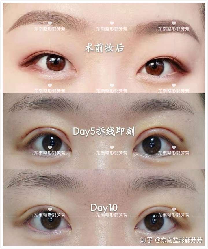 东南整形郭芳芳 大家好,我是东南中大郭芳芳.