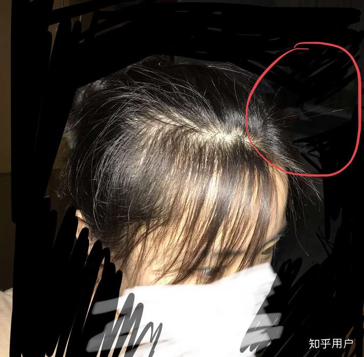 前额碎头发太多扎马尾的时候如何处理?