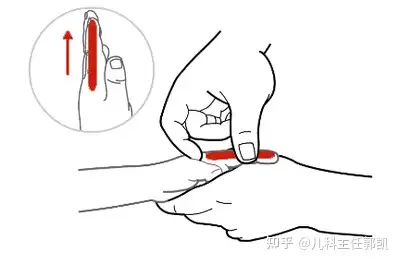 一招改善"大便干燥"清大肠推拿示图