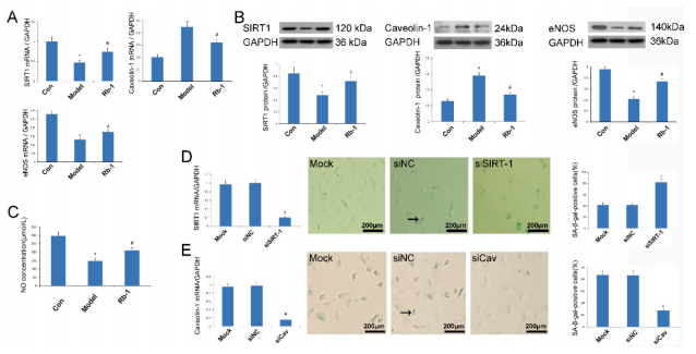 人参皂苷 Rb1通过调控 SIRT1/caveolin-1/eNOS 信号通路来预防年龄相关的血管内皮细胞衰老 人参皂苷 Rb1通过调控 SIRT1/caveolin-1/eNOS 信号通路来预防年龄相关的血管内皮细胞衰老