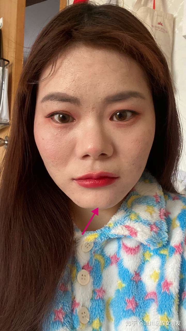 下巴怎么有条线,?