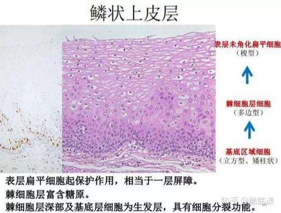 鳞状细胞癌 潜伏的杀手 常见却易被忽视 知乎