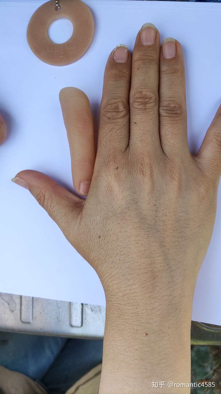 手指缺失9级伤残图图片
