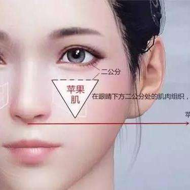 苹果肌并不是肌肉,主要是颧骨前的脂肪组织,"苹果肌"的位置是在眼睛