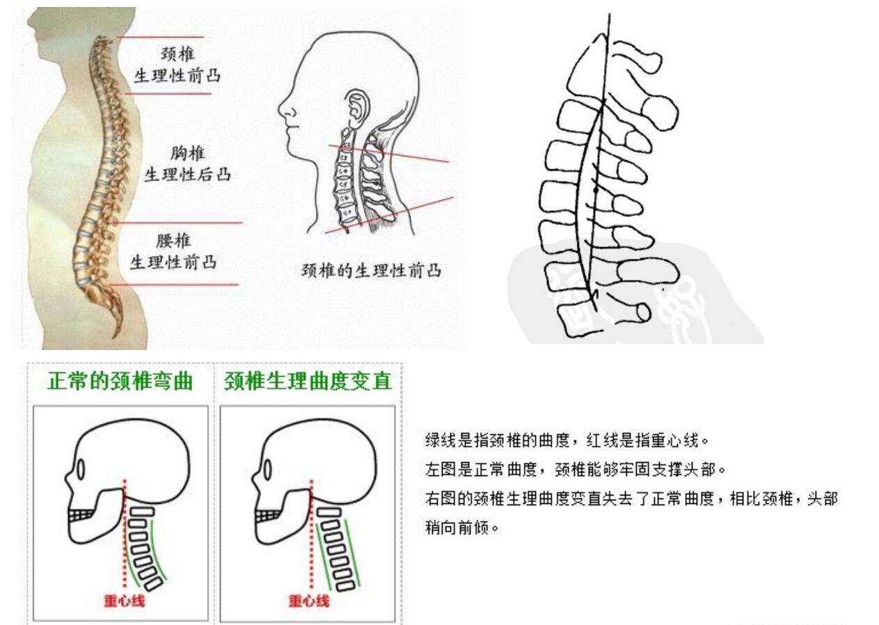 颈椎反弓 是什么鬼 知乎