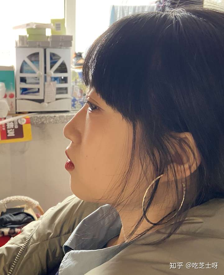 侧面看眼睛非常突,眉骨低和鼻子连接不起来是怎么回事?