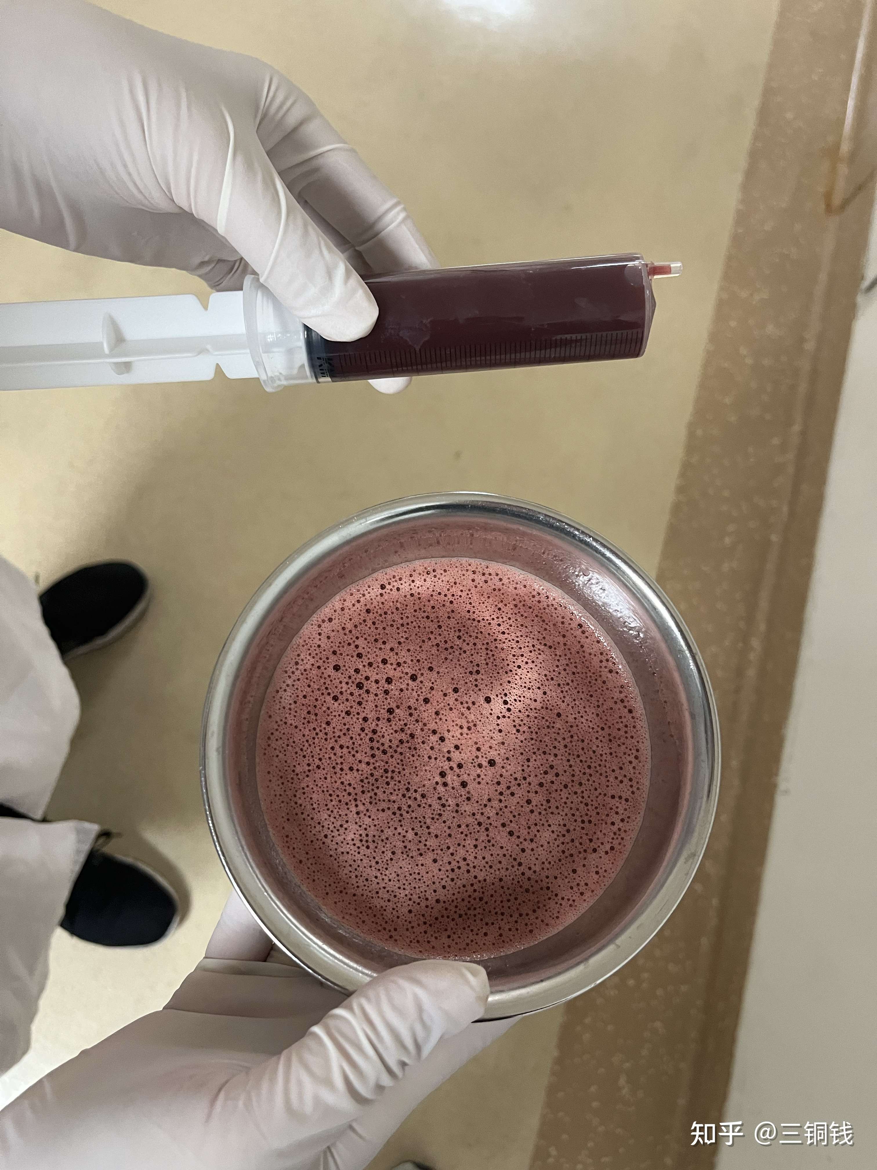 三铜钱 的想法: 血性腹水 - 知乎