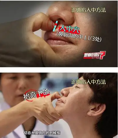 掐人中有什么作用?其原理是什么? - 知乎