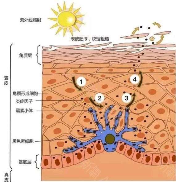 一,色斑形成原因