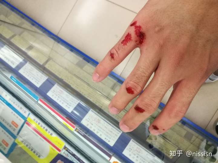 骑行摔车是什么样的体验