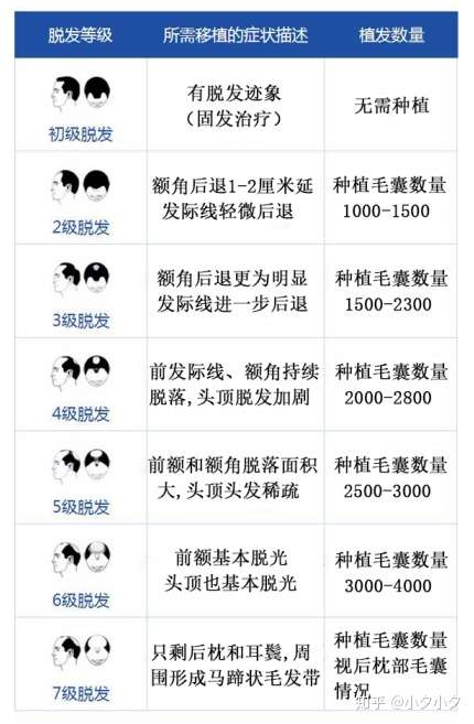 脱发太严重可以植发吗