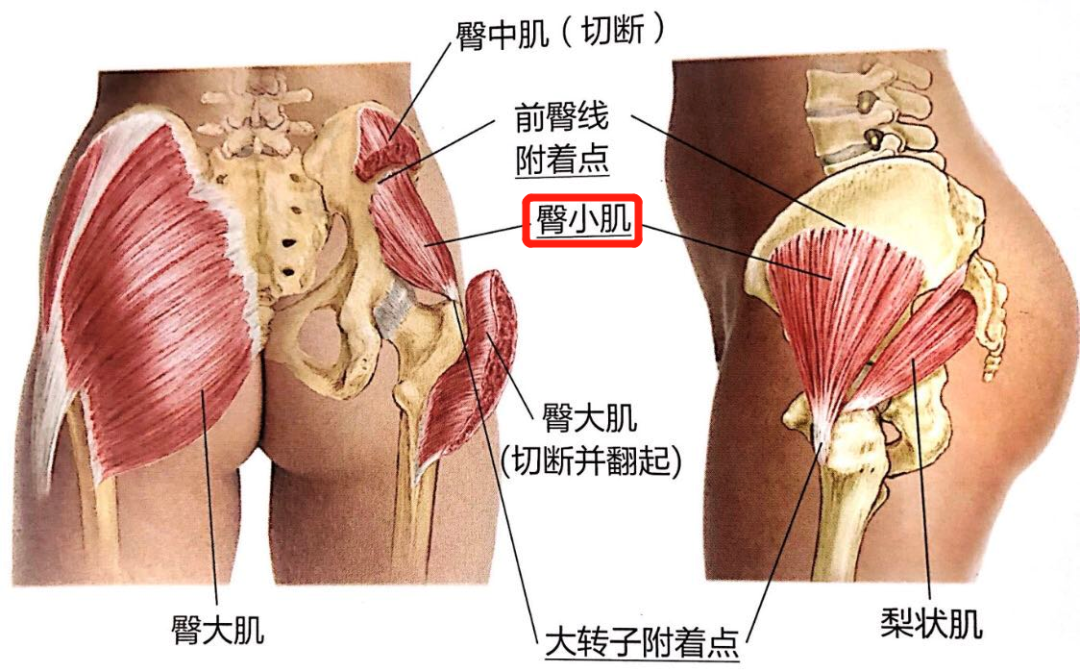 腰突 坐骨神经痛 这种臀腿痛恐怕是 臀小肌 伤了 知乎