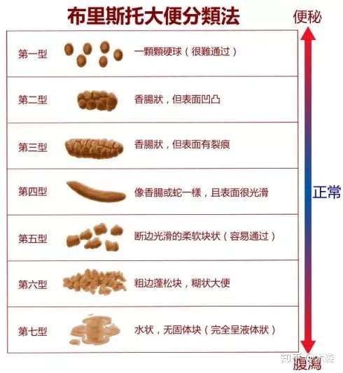 大便哪种状态表示身体最健康 知乎