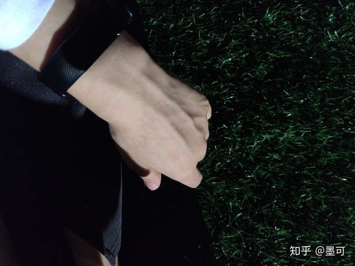 我一姑娘手青筋这般凸爆,以后会越来越严重吗?