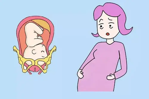 胎兒入盆就是要生了嗎（胎兒入盆是什么感覺）插圖(1)