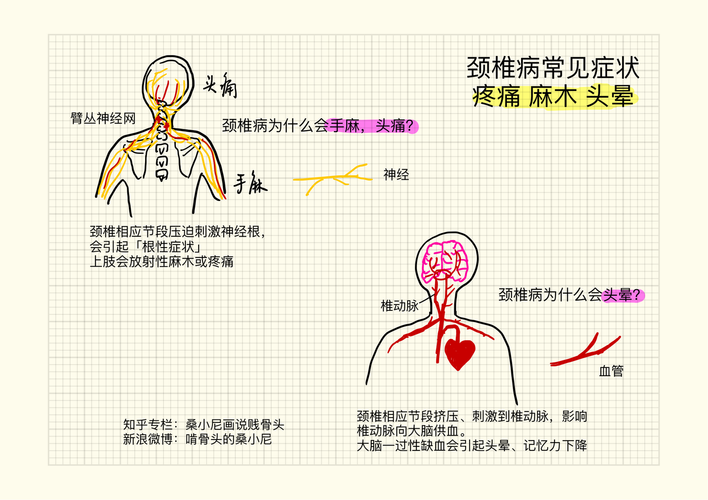 颈椎病自查小贴士 知乎