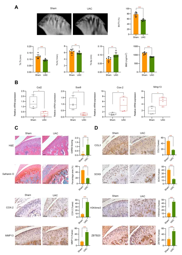 異常流體剪切應力通過 H3K4me3 對 ZBTB20 的表觀遺傳調控促進關節軟骨發病機制
