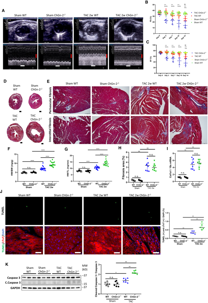 ChGn-2（硫酸軟骨素N-乙酰氨半乳糖胺基轉(zhuǎn)移酶2）在急性壓力超負(fù)荷引起的心力衰竭中起心臟保護(hù)作用