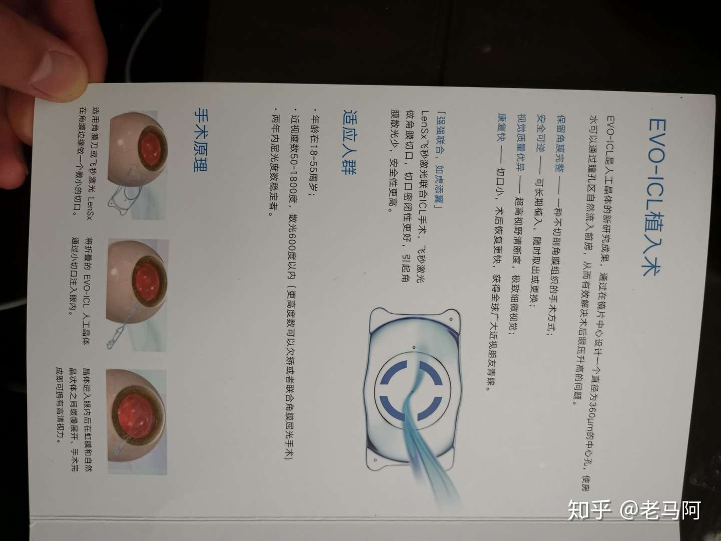 做完个性化半飞秒激光手术一个月后的感受 知乎