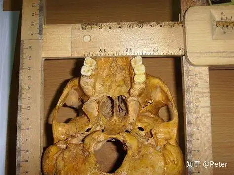 高考3500词汇题 十七 什么是头盖骨测量学 Craniometry 脑子越重 人就越聪明吗 爱因斯坦大脑有多重 大猩猩大脑有多重 知乎