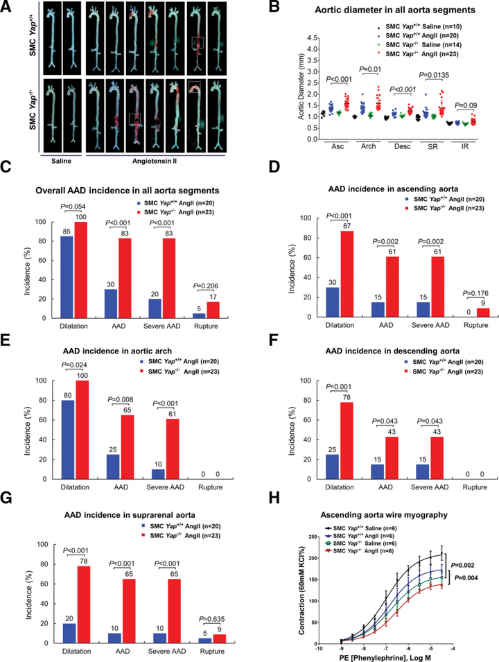 小鼠主動(dòng)脈應(yīng)力激活胸主動(dòng)脈平滑肌細(xì)胞中的適應(yīng)性程序，維持主動(dòng)脈強(qiáng)度并防止動(dòng)脈瘤和夾層