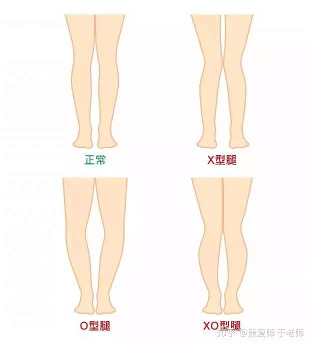 腿型不好 想改善 这几种方法你快试试 知乎 腿型不好 想改善 这几种方法你快试试 知乎