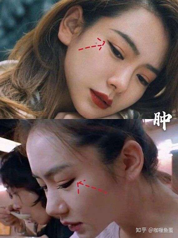 为什么说明星里面张雨绮做的双眼皮最成功