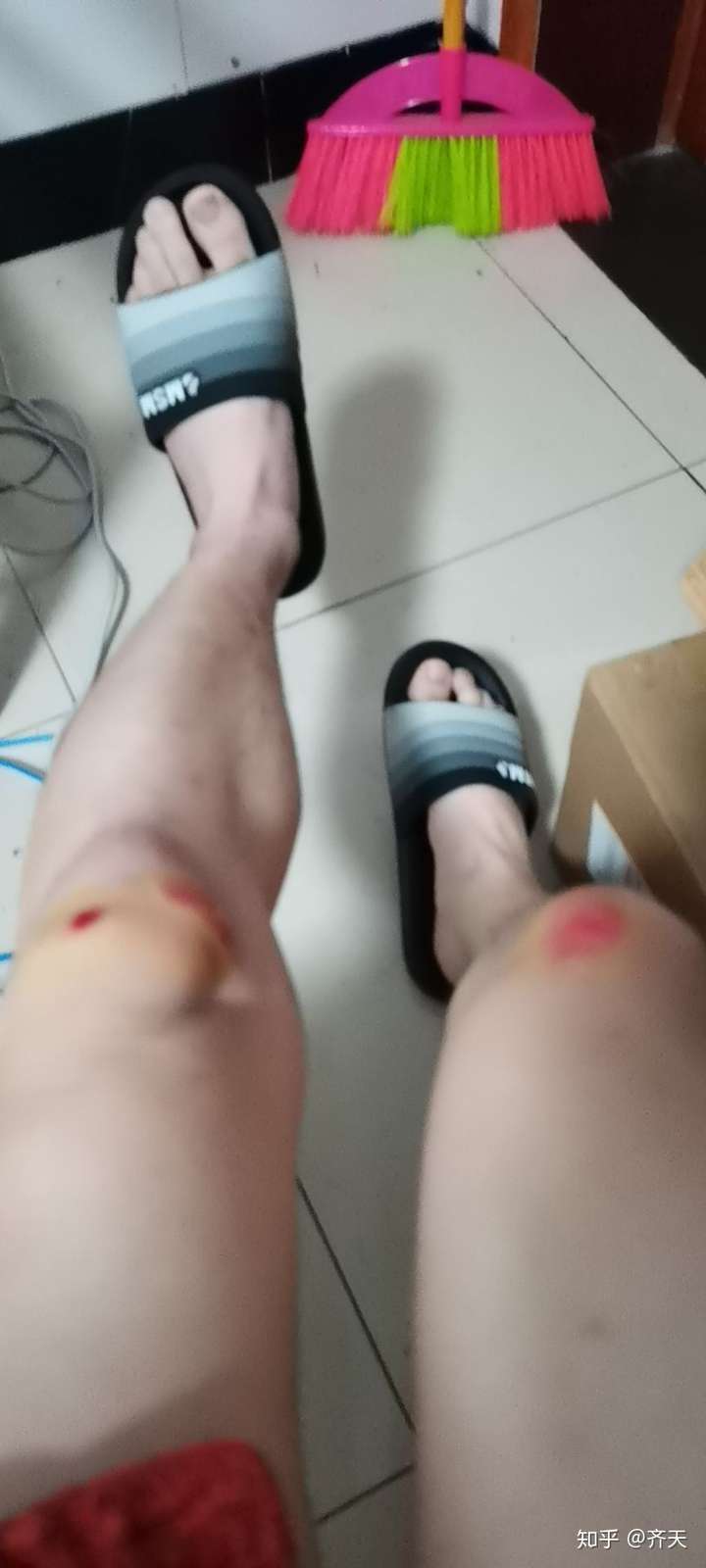 你们骑电动车摔过跤吗?