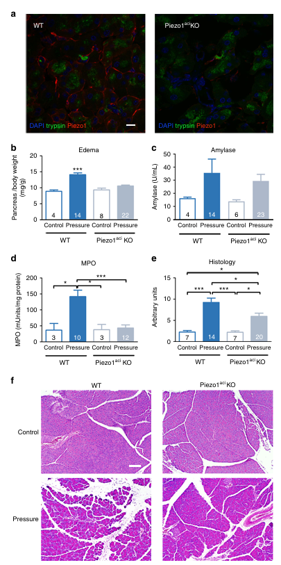 Piezo1是一種介導壓力誘導胰腺炎的機械激活離子通道