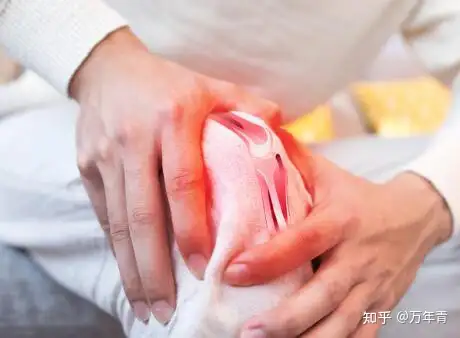 预防膝关节炎 从这四点出发 知乎