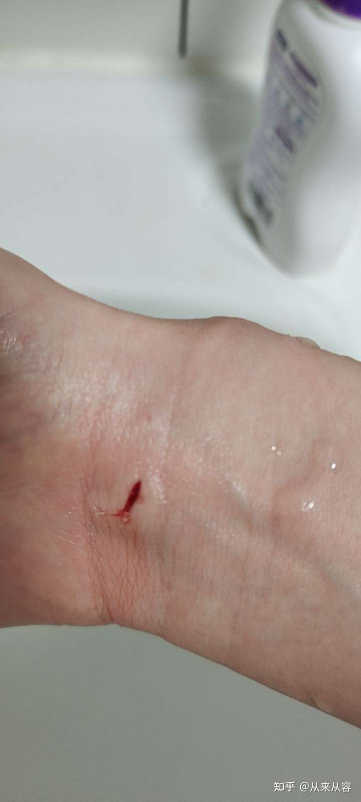 你被猫抓得最惨的一次到什么程度?