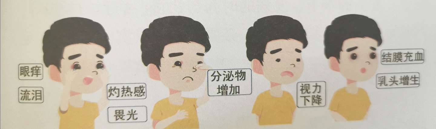 尘螨过敏之过敏性结膜炎不是小事 别大意 知乎 尘螨过敏之过敏性结膜炎不是小事 别大意 知乎