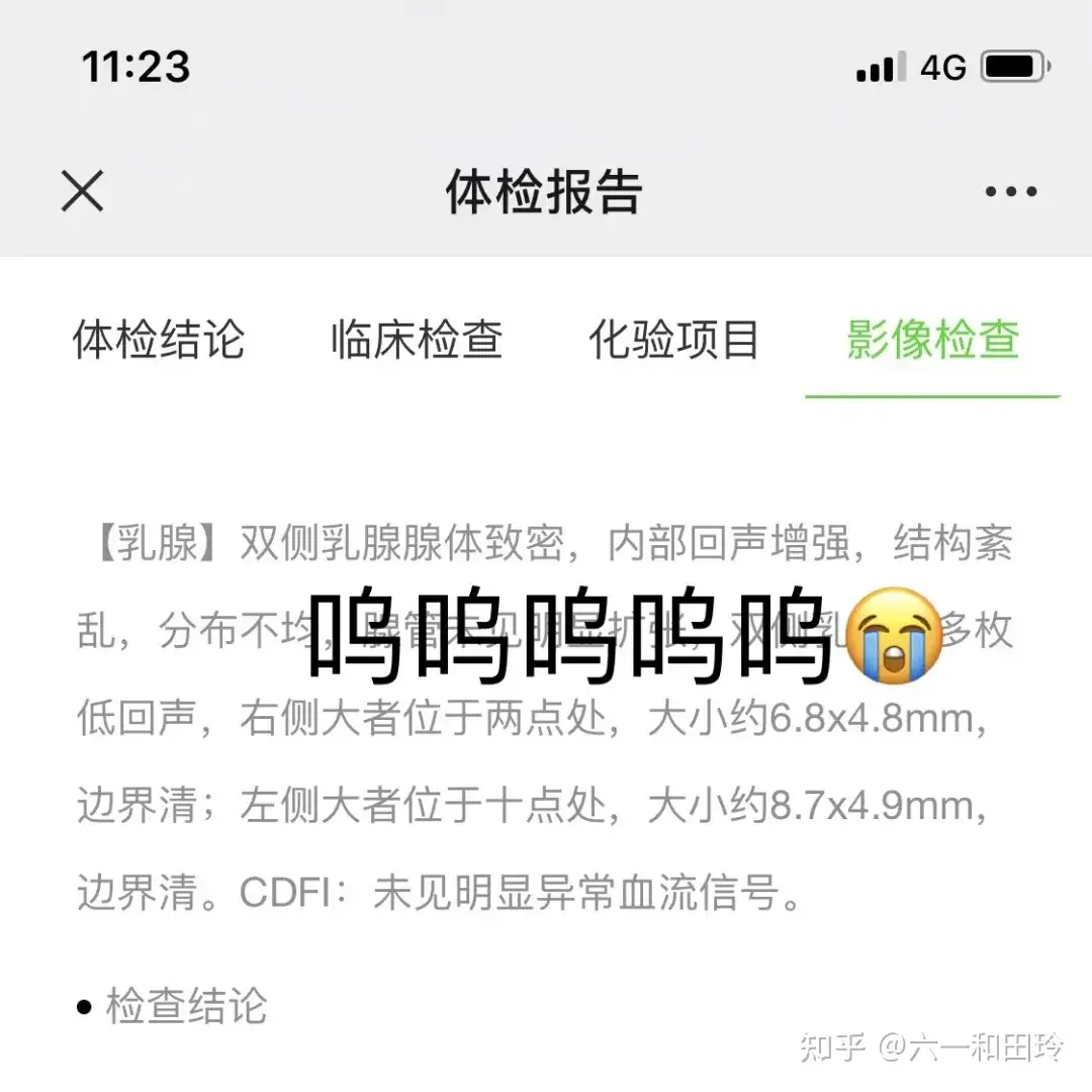 忍一时卵巢囊肿 退一步乳腺增生 知乎