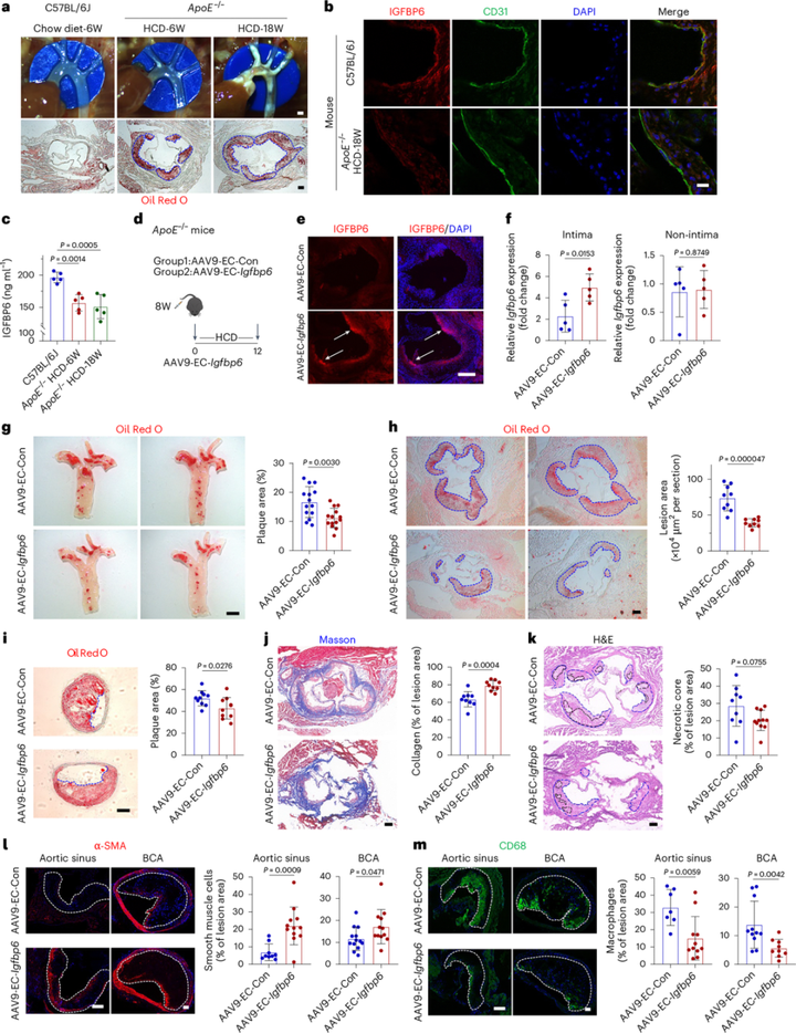 内皮胰岛素样生长因子结合蛋白6（IGFBP6）抑制血管炎症和动脉粥样硬化