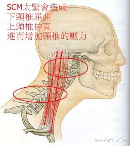 浅谈胸锁乳突肌 知乎