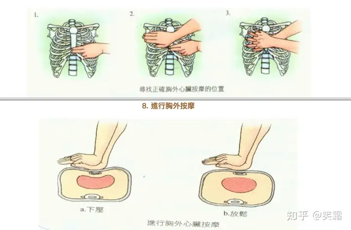 专家称心源性猝死突发时速效救心丸可能无法有效急救猝死，为什么？