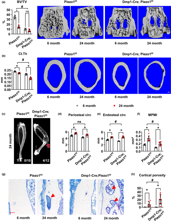 Piezo1 對抗與衰老相關的皮質骨丟失