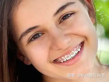 矫正骨突出上颌会歪吗_上颌骨突出怎么矫正_上颌骨突出正畸有效果吗