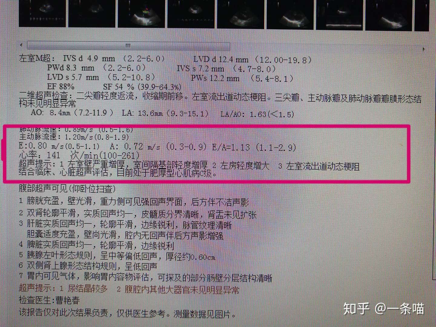 简单概述下自家猫咪突发肺部水肿的全过程- 知乎