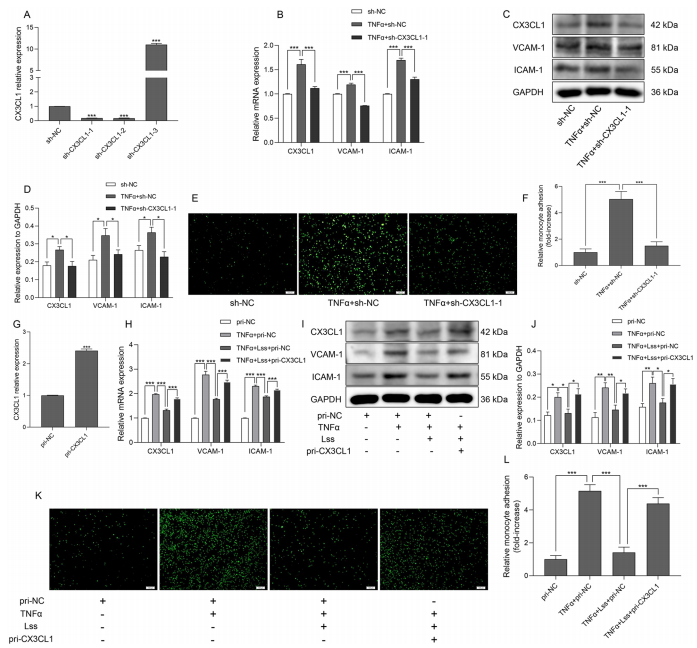 層流剪切應力通過調控 miR - 29b - 3p/CX3CL1 軸減輕單核細胞黏附及動脈粥樣硬化發展 層流剪切應力通過調控 miR - 29b - 3p/CX3CL1 軸減輕單核細胞黏附及動脈粥樣硬化發展