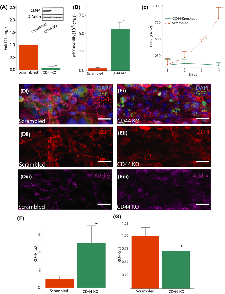 CD44 通过小 GTP 酶 RhoA 和 Rac1 介导体外血脑屏障模型中的剪切应力机械转导